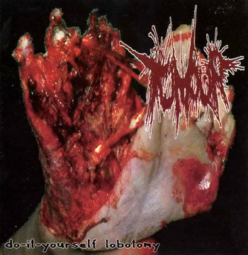 TUMOUR / ANAL PENETRATION - SPLIT CD